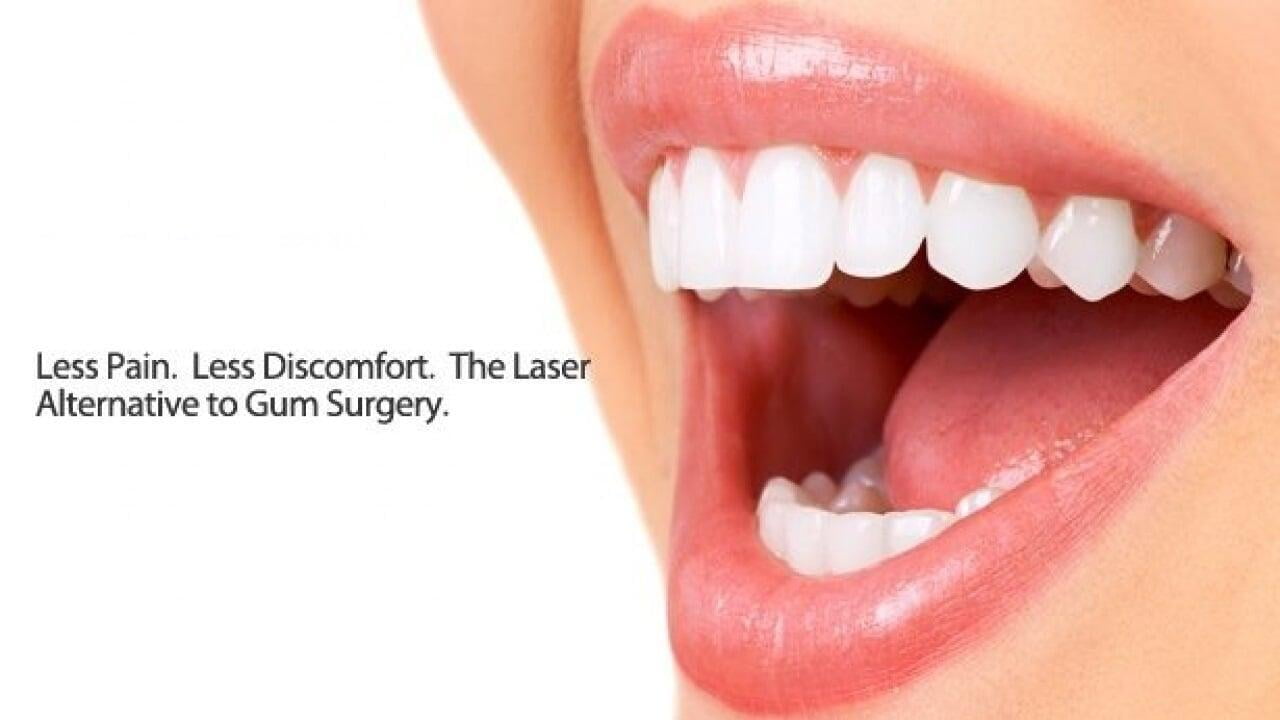 Laser Assised GUM Surgeries At Greater Noida